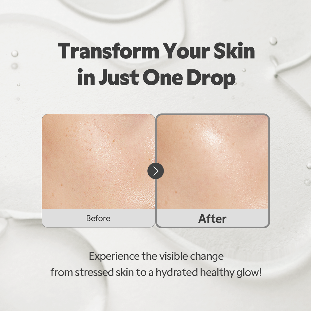 SOS Serum